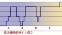 谈睡眠管理及REM睡眠机制的应用